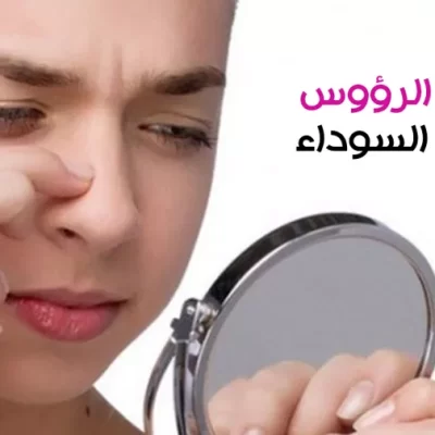 الرؤوس السوداء